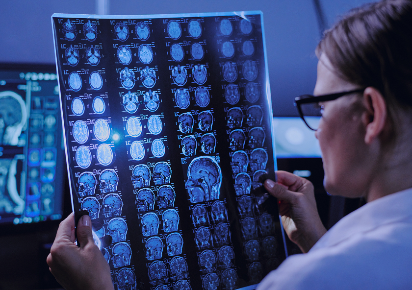 Genistein: a possible solution for the treatment of Alzheimer’s disease. Neural Regen Res